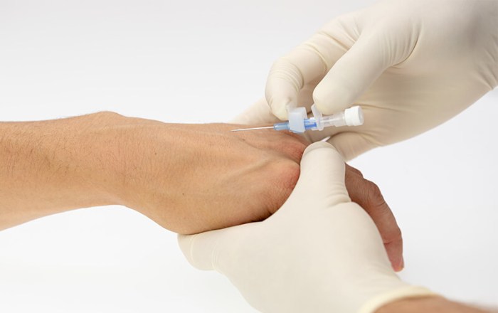 A nurse is discontinuing a peripheral iv catheter